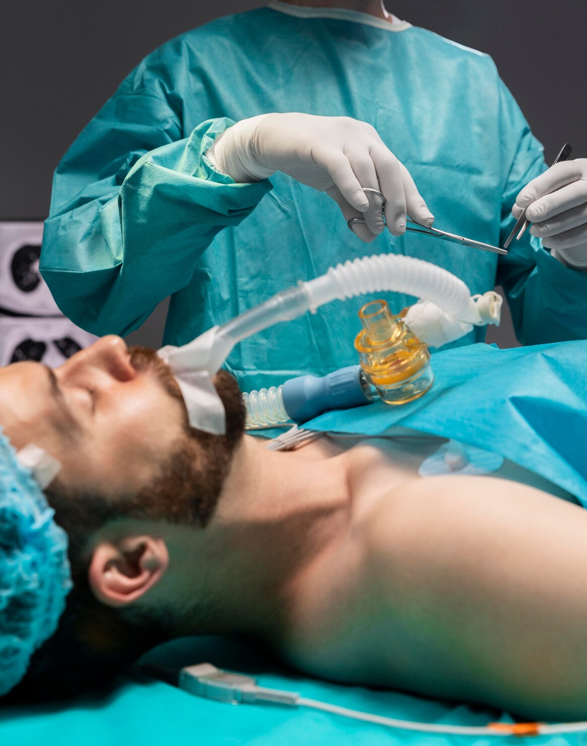 NBE Anesthesia
